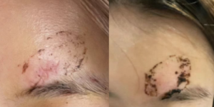 王礼君荣获拾遗传承“王氏传统膏药制作技艺非物质文化遗产传承人”称号