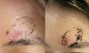 王礼君荣获拾遗传承“王氏传统膏药制作技艺非物质文化遗产传承人”称号